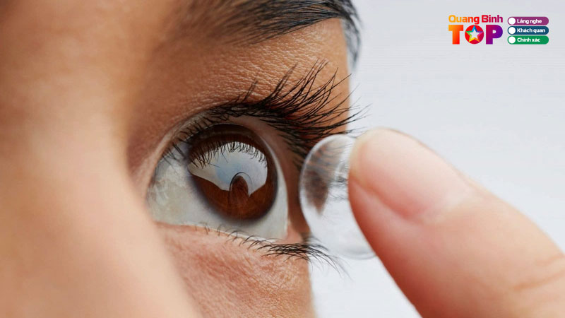 Thumbnail-kinh-ap-trong-quangbinhtoplist