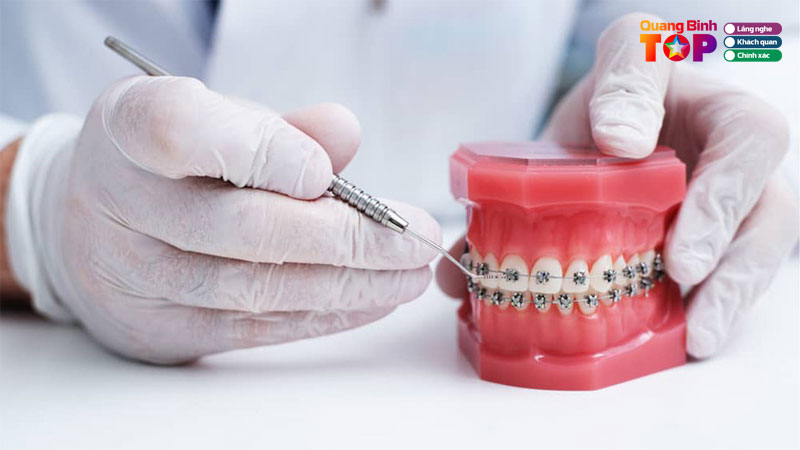 Thumbnail-nieng-rang-o-quang-binh-quangbinhtoplist