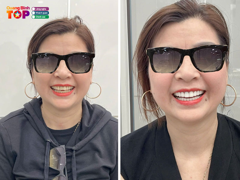 Nha-khoa-viet-phap-quangbinhtoplist