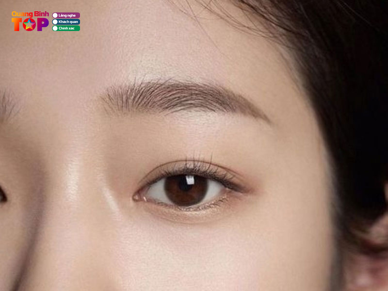 Tham-my-vien-bena-usa-quangbinhtoplist