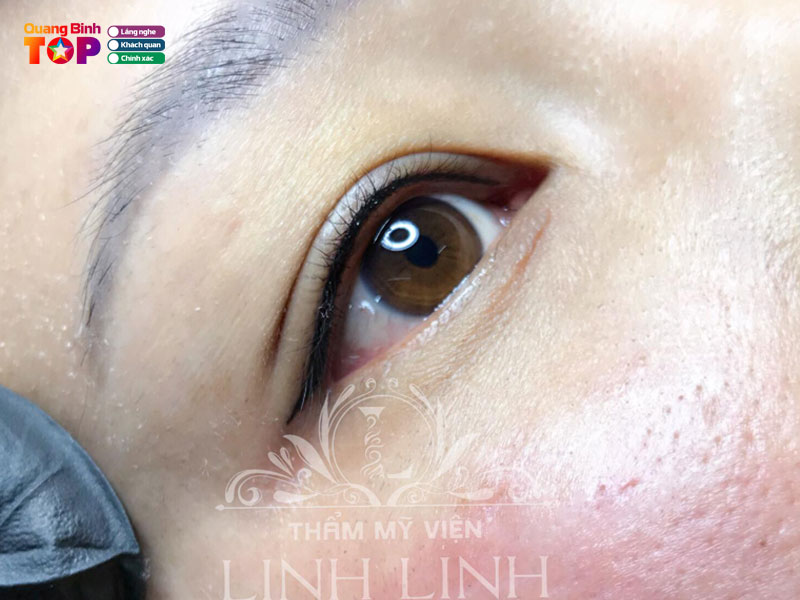 Tham-my-vien-linh-linh-quangbinhtoplist