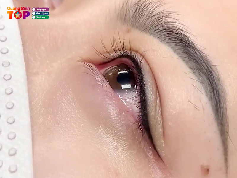 Tham-my-vien-my-dung-quangbinhtoplist