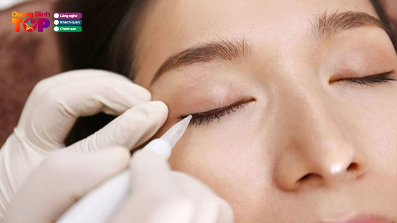 Top-10-dia-chi-phun-mi-mat-tai-quang-binh-dam-bao-khong-dau-quangbinhtoplist