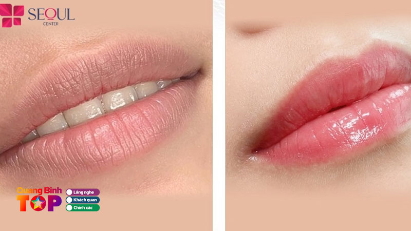 Tham-my-vien-seoul-center-quangbinhtoplist