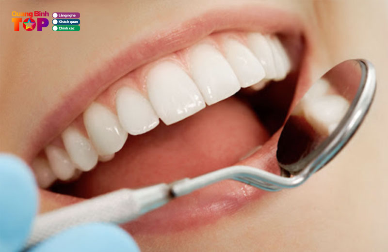 Vi-sao-yeu-to-dong-hanh-quyet-dinh-chat-luong-nha-khoa-quangbinhtoplist