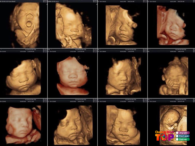 Phong-kham-bac-sy-tra-va-cong-su-quangbinhtoplist