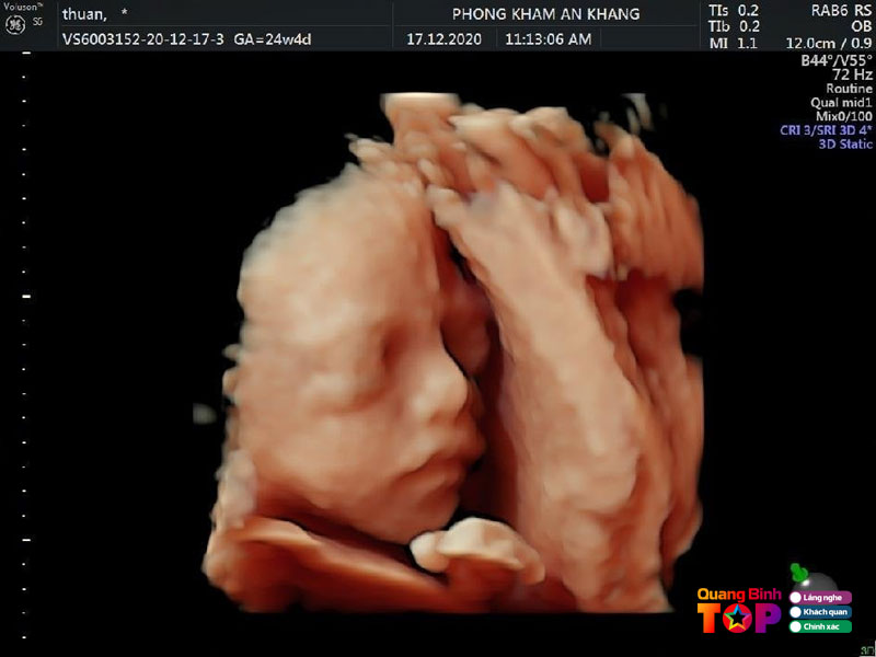 Phong-kham-da-khoa-an-khang-quangbinhtoplist