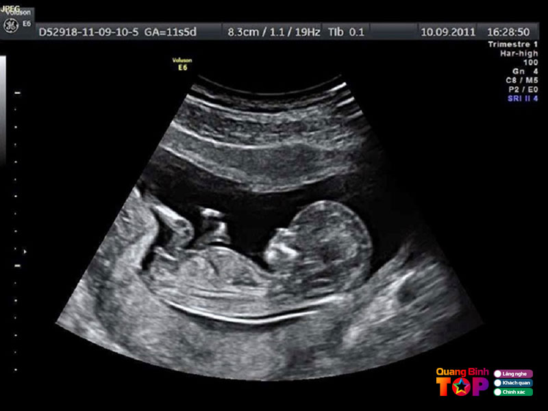 Phong-kham-san-phu-khoa-bac-si-khoi-quangbinhtoplist