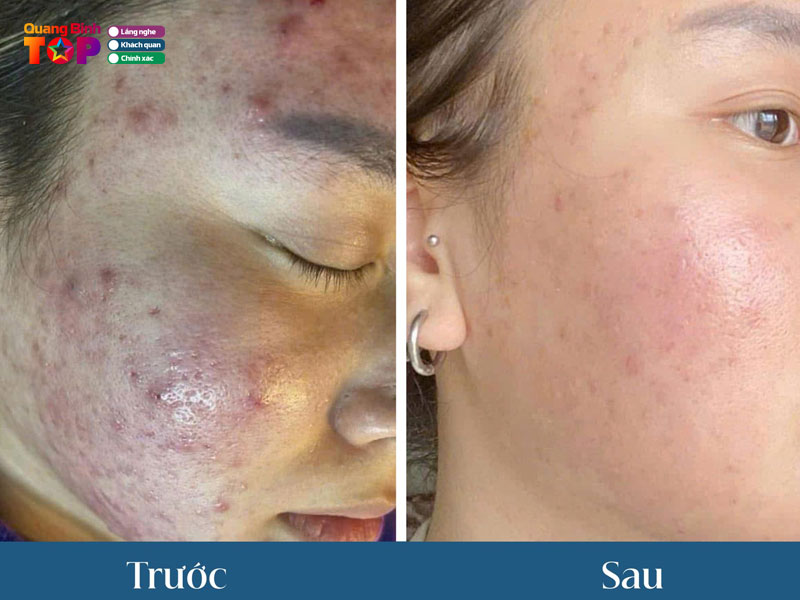 Asena-spa-quangbinhtoplist