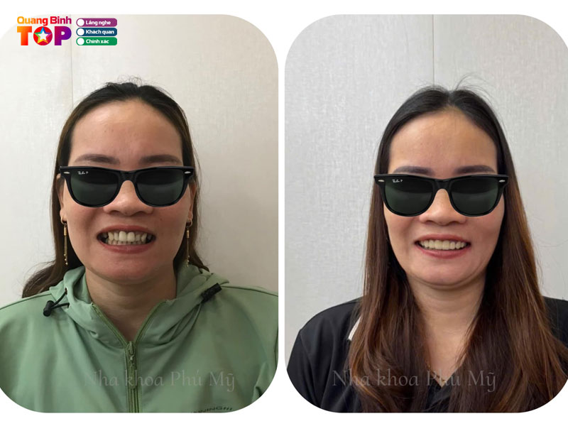 Nha-khoa-phu-my-quangbinhtoplist