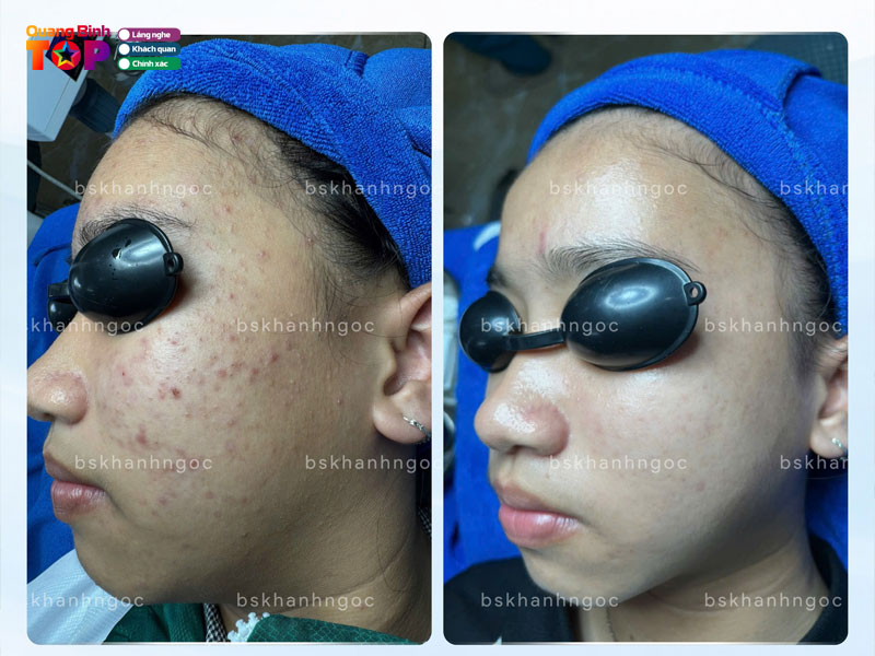 Phong-kham-da-lieu-tham-my-khanh-ngoc-quangbinhtoplist