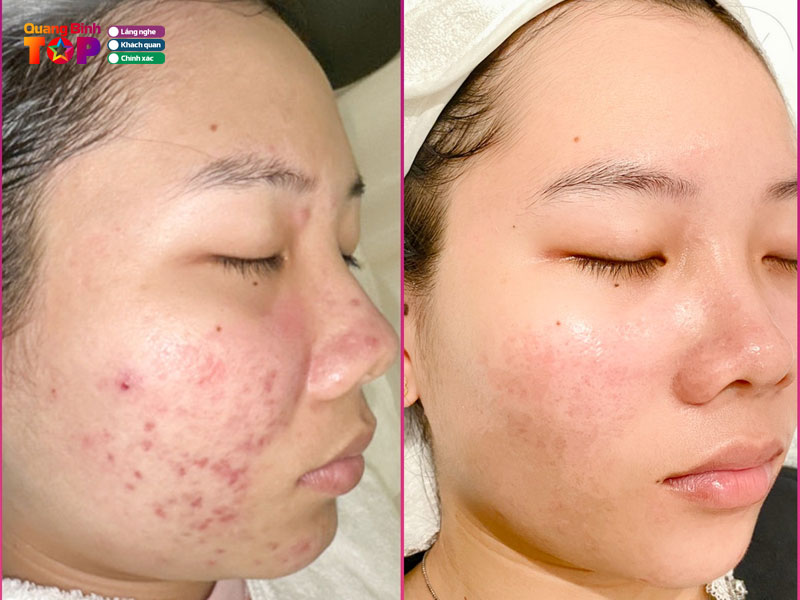 Seoul-center-quangbinhtoplist