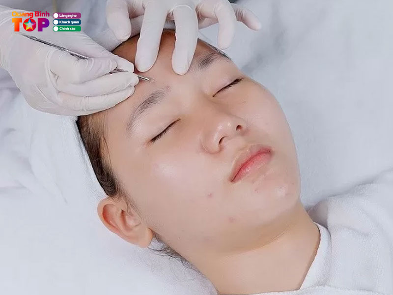 Tieu-chi-chon-dia-chi-tri-mun-quang-binh-quangbinhtoplist