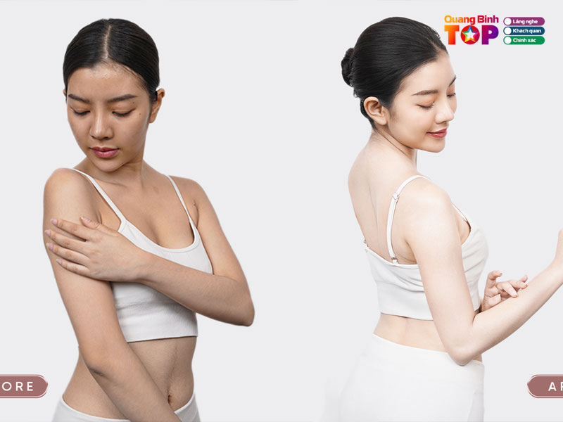 Asena-spa-quangbinhtoplist