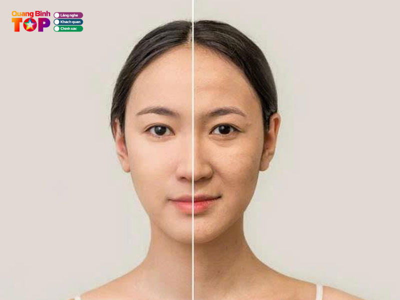 Khoa-da-lieu-benh-vien-da-khoa-tth-quang-binh-quangbinhtoplist