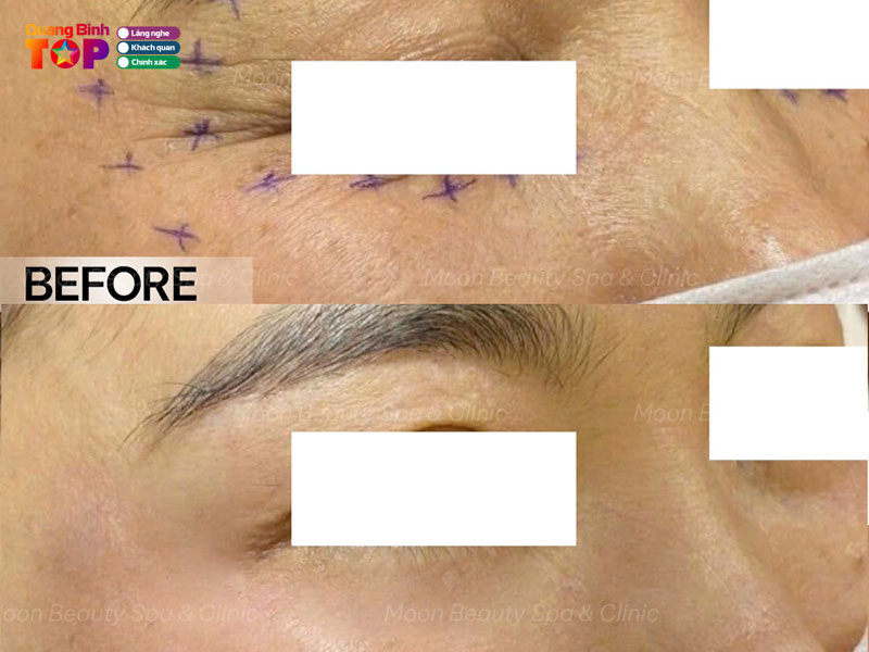 Moon-beauty-spa-clinic-quangbinhtoplist