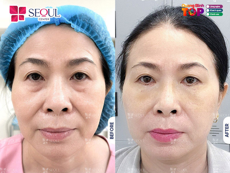 Seoul-center-quangbinhtoplist