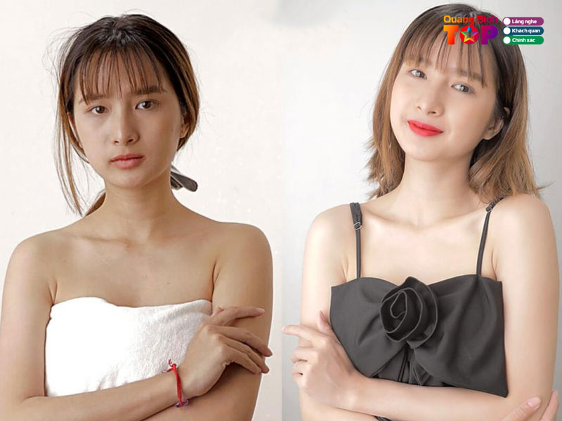 Tieu-chi-chon-spa-tam-trang-quang-binh-quangbinhtoplist