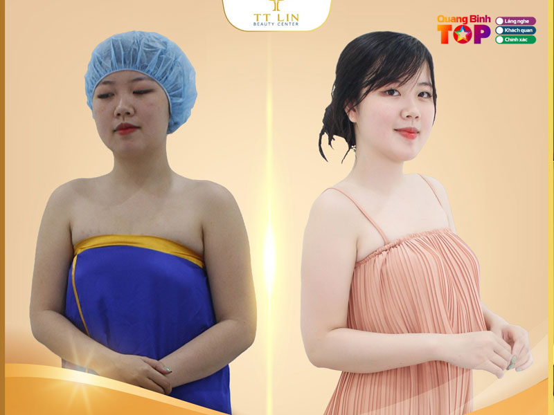 Tt-lin-beauty-quangbinhtoplist