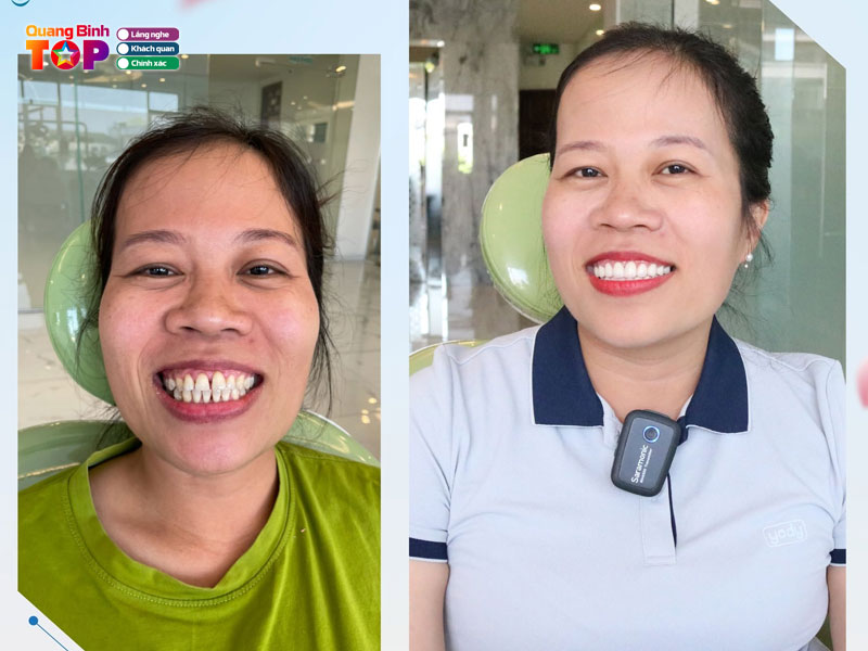 Nha-khoa-sai-gon-new-dental-quangbinhtoplist