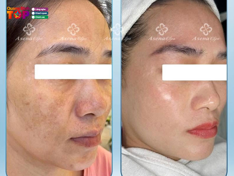 Asena-spa-quangbinhtoplist