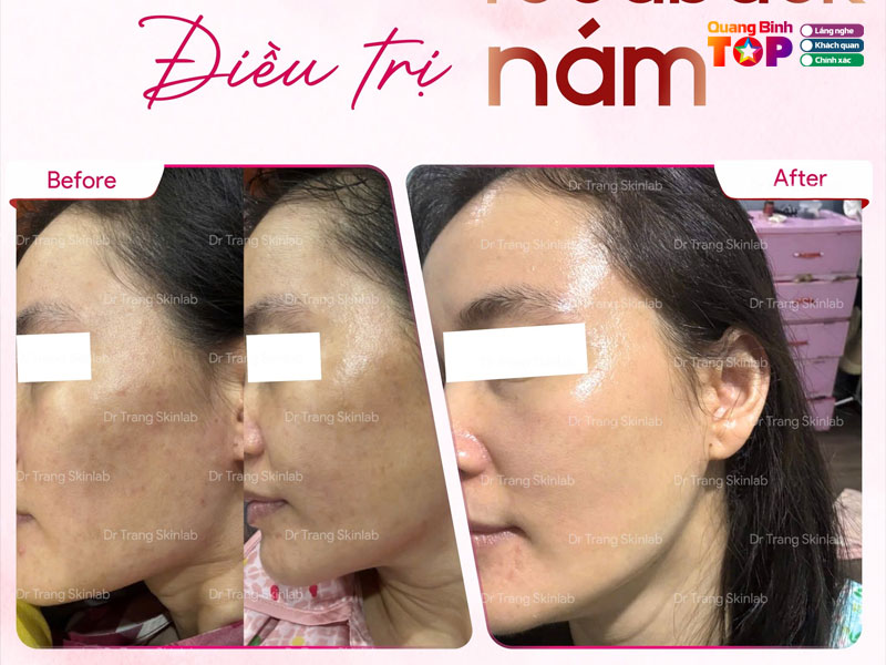 Dr-trang-skinlab-quangbinhtoplist