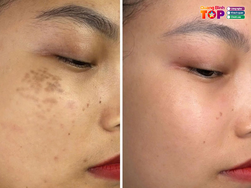 Moon-beauty-spa-clinic-quangbinhtoplist