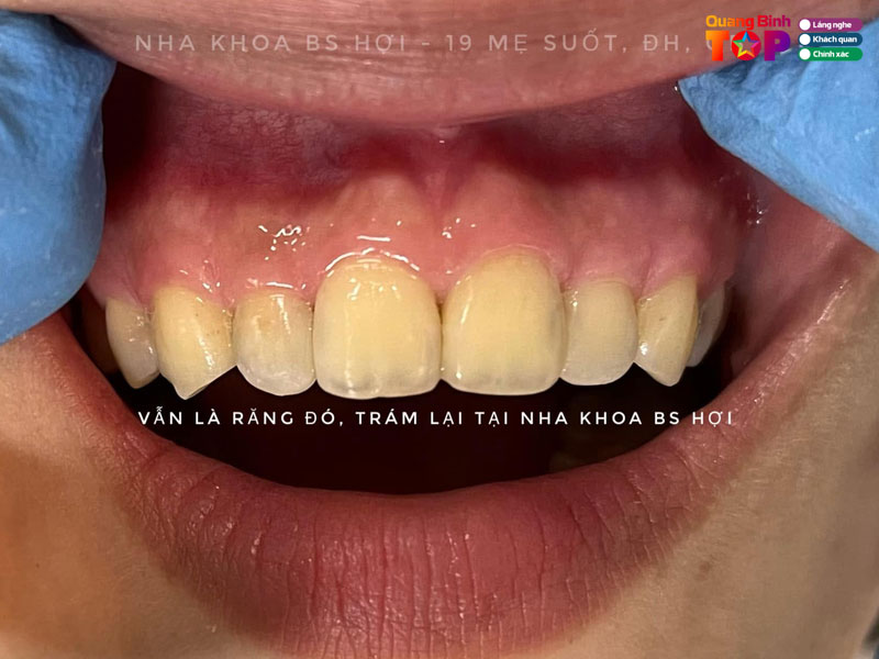 Nha-khoa-bac-si-hoi-quangbinhtoplist