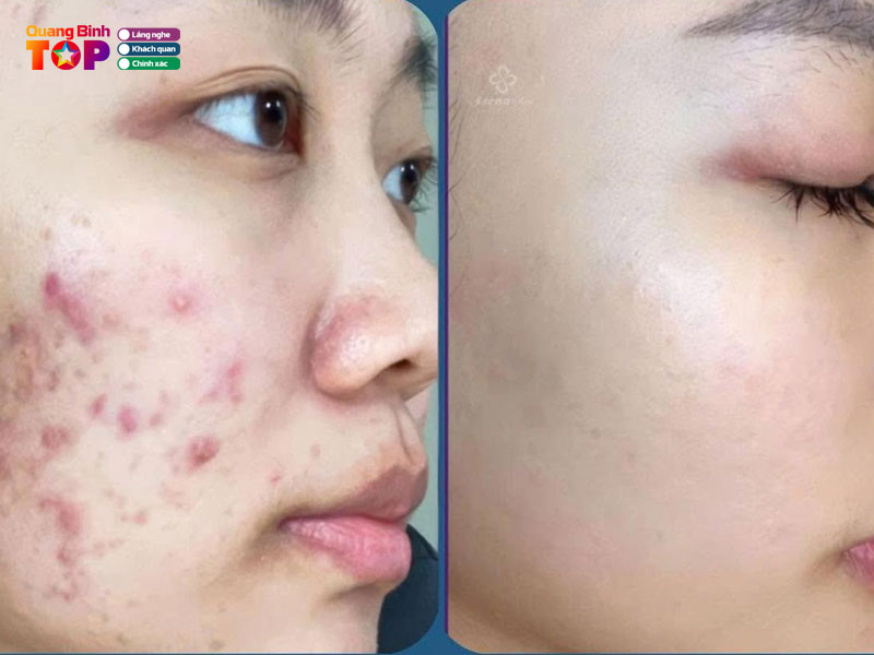 Asena-spa-quangbinhtoplist