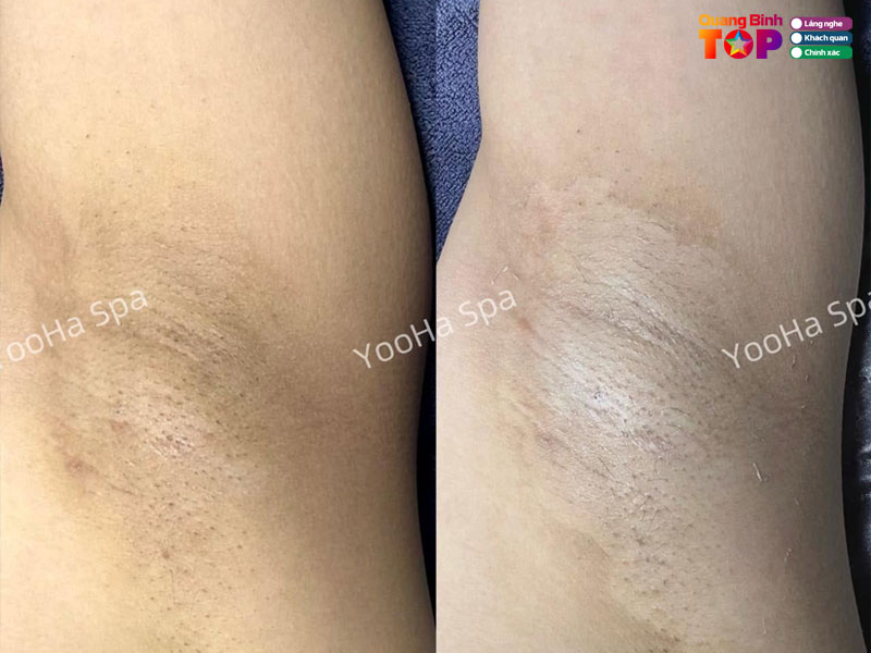 Yooha-spa-quangbinhtoplist
