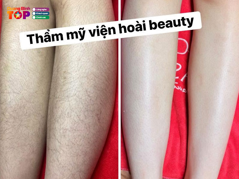Hoai-beauty-quangbinhtoplist