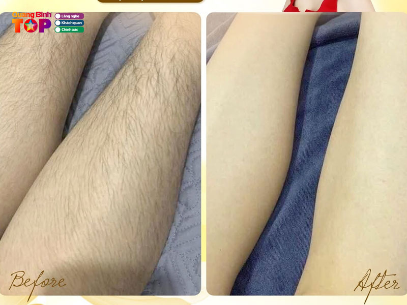 Vo-ly-beauty-spa-quangbinhtoplist